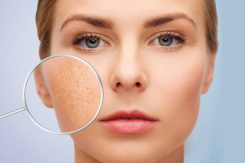 Cách cân bằng da hiệu quả