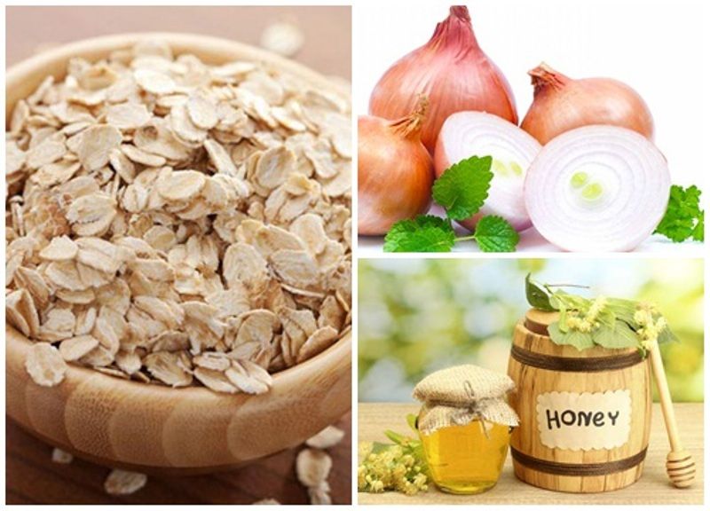 Cách chăm sóc da mụn bằng hành tây Cách chăm sóc da mụn bằng hành tây