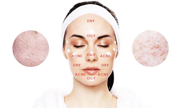 Cách chọn kem dưỡng ẩm phù hợp cho mọi loại da 3 - Cách chọn kem dưỡng ẩm phù hợp cho mọi loại da, - cách chọn kem dưỡng ẩm, chăm sóc da, da hỗn hợp, da khô, da nhạy cảm, da thường, kem dưỡng ẩm cho da dầu, kem dưỡng ẩm cho da khô - Mỹ phẩm làm đẹp, trang điểm, chăm sóc da hiệu quả an toàn Da hỗn hợp