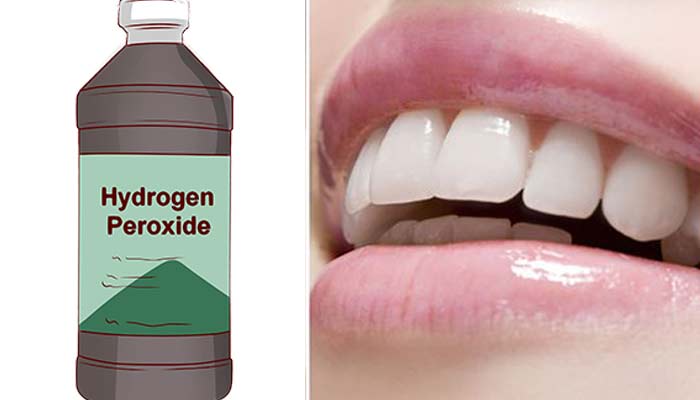 Hydrogen peroxide Hydrogen peroxide